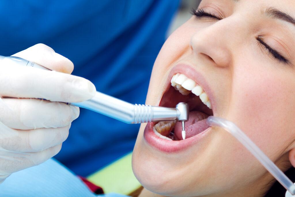 Dental Extractions